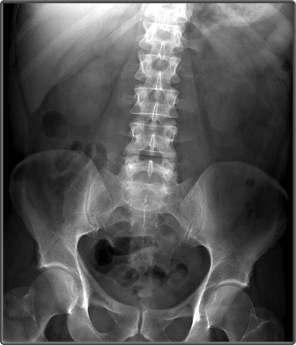 Abdomen & Pelvis X-ray